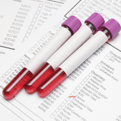 Blood Test Analysis - TransformNow