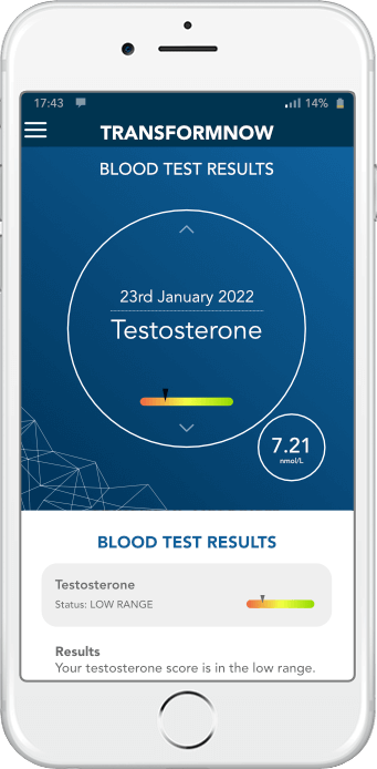 low testosterone test results